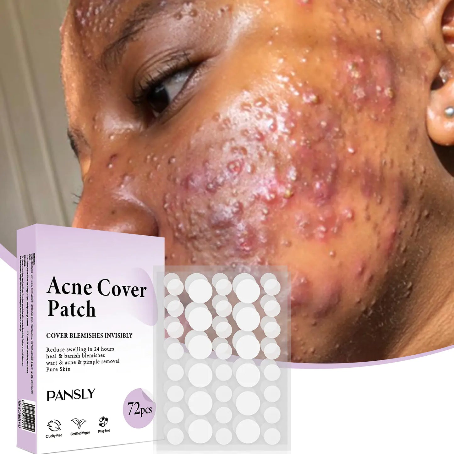 Patchs Soins de la Peau Anti-Acné - 72 Pcs