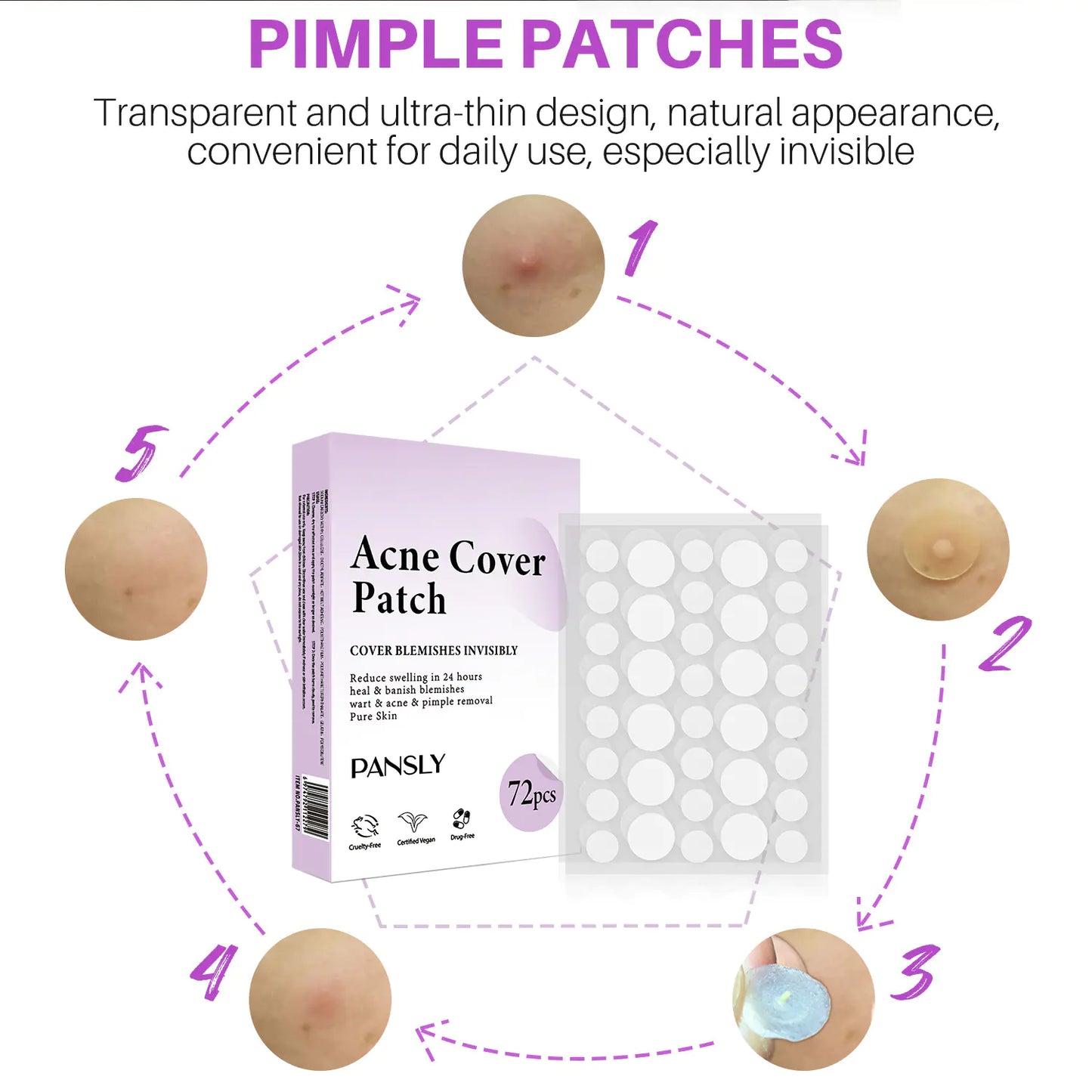 Patchs Soins de la Peau Anti-Acné - 72 Pcs