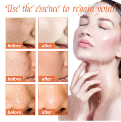 Sérum Visage Hydratant aux Peptides de Collagène pour une Peau Ferme