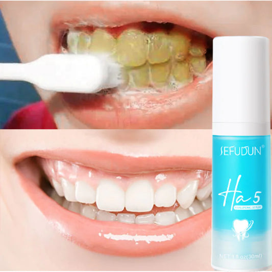 Dentifrice Anti-Allergique pour Haleine Fraîche et Soin de l'Émail