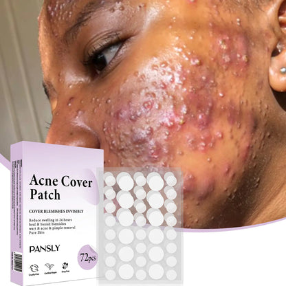 Patchs Soins de la Peau Anti-Acné - 72 Pcs